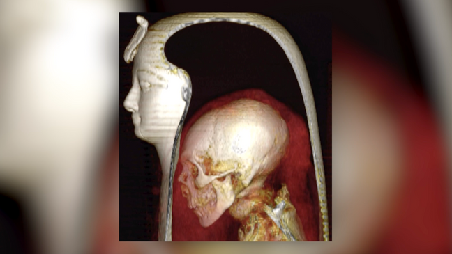 The 3,500-year-old mummy of an Egyptian king has been 'digitally unwrapped' for the first time. (Photo:{&nbsp;} S. Saleem and Z. Huwass via CNN Newsource)