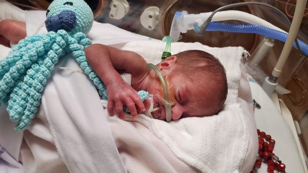 Little Maximus Diaz was born nearly four months premature, and is fighting for his life amid the COVID-19 pandemic. (Courtesy: Diaz Family)